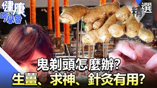 鬼剃頭怎麼辦？ 生薑、求神、針灸有用？【57健康同學會】精華篇｜廖慶學 嚴立婷 楊庭驊 劉禮維 李芳瑜 王瑞玲