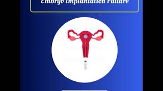 Causes of Failed IVF Treatment Cycles