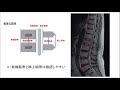 【mri　腰椎周囲の診るポイント、コツ】理学療法士国家試験・作業療法士国家試験　pt・ot・st・看護師　＃理学療法士　＃作業療法士　＃国試