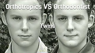 Why You Shouldn't Extract Teeth: Orthotropics VS Orthodontist | Dispatches 1999