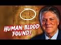 Blood Test BOMBSHELL on the Shroud of Turin!