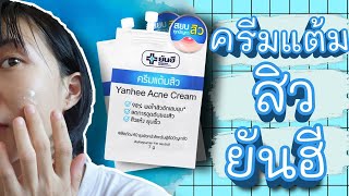 รีวิวครีมแต้มสิวยันฮี Yanhee Acne Cream สิวอักเสบ สิวอุดตัน สิวแห้ง ยุบเร็ว #ไปหาลอง | WaanSannie