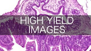 High Yield USMLE/COMLEX Images (pt. 2)