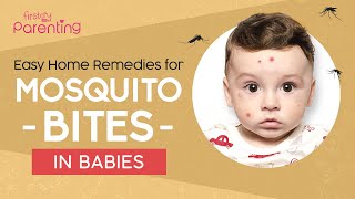 10 Easy Home Remedies for Mosquito Bites on Babies and Kids