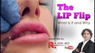 The Lip Flip What it is and When to Use it Lip Injections Portland