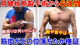 手術後6週間の筋肉の左右差を腕周りと胸や背中を比較して検証！筋トレを休んだ時の筋肉の落ち方【腱板断裂】