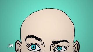 Why Do Some Men Go Bald?