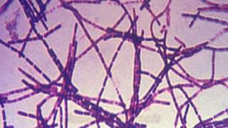 Anthrax and Bacillus anthracis