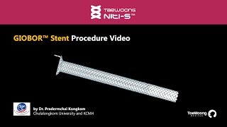 GIOBOR™ Stent Procedure Video - Dr. Kongkam