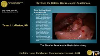 Devil's in the Details: Gastro-jejunal anastomosis The Circular Anastamotic Gastrojejunostomy