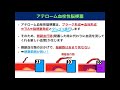 教科書をわかりやすく！「脳梗塞の病態まとめ」アテローム性・心原性・ラクナの違いとは？