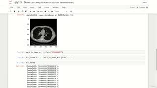 3 DICOM in Python
