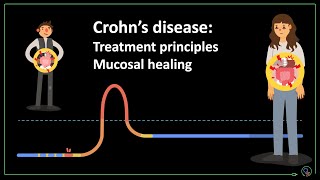 Crohn's disease: treatment principles and mucosal healing