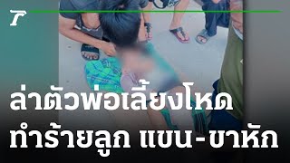 เร่งจับพ่อเลี้ยงโหดทำร้ายลูกวัย 1 ขวบ แขน-ขาหัก  | 20-01-66 | ข่าวเย็นไทยรัฐ