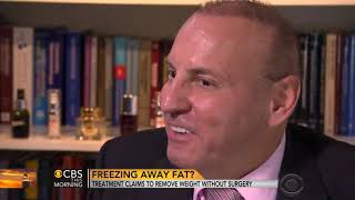 CBS News on CoolSculpting