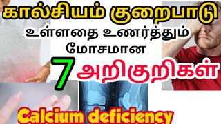 calcium deficiency symptoms tamil| கால்சியம் குறைபாடு அறிகுறிகள்| Calcium food tamil| bone weakness