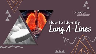 Ultrasound Lung A Lines #2