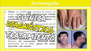 ⚕️🩺 Acromegalia y Gigantismo HIPERSECRECIÓN DE HORMONA DEL CRECIMIENTO: Síntomas y Tratamiento