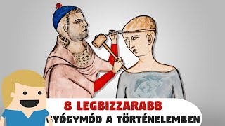 8 legbizarrabb orvosi tévhit a történelemből!