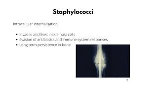 Periprosthetic joint infection (PJI) in adults