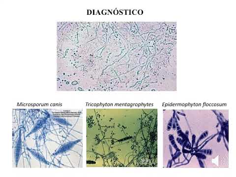 SEMINARIO 10- Microbiología 1 Cat 2 FMed UBA - YouTube