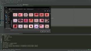SKIN DISEASE CLASSIFICATION using PYTORCH | Machine Learning | Project | Python Language