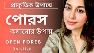 ওপেন পোরস ও লার্জ পোরসের সমাধান, খুব সহজেই মুক্তি পান তেলেতেলে পোরসের হাত থেকে