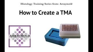 How to Create A TMA