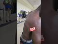Shocking scenes as Ghanaian evacuee reveals injuries from SA xenophobic unrest