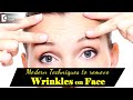 Use of laser to remove fine lines on face. Procedure & Life- Dr. Rajdeep Mysore| Doctors' Circle