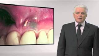 Dr. Ruddle on Endodontic Diagnosis | Dentsply Sirona