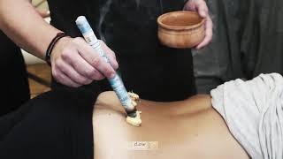 Moxibustion techniques