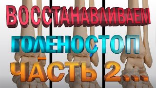 Упражнения для восстановления голеностопа после перелома. Часть 2... Плоскостопие.