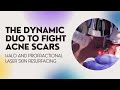 THE DYNAMIC DUO TO FIGHT ACNE SCARS | HALO AND PROFRACTIONAL LASER SKIN RESURFACING | Dr. Jason Emer