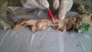 Gross Anatomy of Pancreas