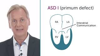 What is a primum defect:ASD I?