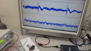 超音波プローブの伝搬特性テスト－－低周波の共振現象と、高周波の非線形現象を発振制御するメガヘルツの超音波システム技術ーー（超音波システム研究所）