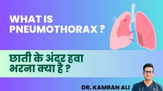 Pneumothorax kya hai - छाती के अंदर हवा भरना क्या है? || Pneumothorax kya hota hai