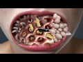 asmr maggot and worm removal animation treatment life @sanaanimation0