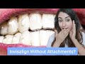 Can I Have Invisalign Without Attachments?