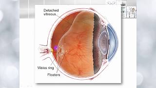 Vitreous anatomy and functions