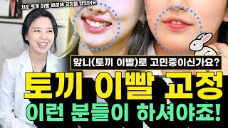 🐰토끼 이빨🐰 꼭 교정해야할까요? (수지, 나연, 안유진 🐰이빨)  | 꼭 토끼이빨은 교정을 해야하는 이유