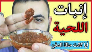 علاج طبيعي جبار لتكثيف و اطالة شعر اللحية أيا كانت حالة الدقن - How To Grow A Beard