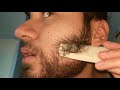 in depth tour of my minoxidil beard update