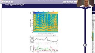 A Kalman-based Fundamental Frequency Estimation Algorithm