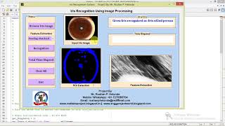 Iris Recognition and Classification Using Image Processing Matlab Project with Source Code