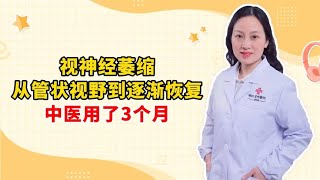 视神经萎缩 从管状视野到逐渐恢复 中医用了3个月