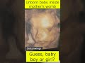 Unborn Baby inside Mother's Womb, Guess Baby Boy or Girl?  #cute #cutebaby #shorts #solconwings