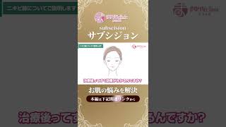 お肌の治療「サブシジョン」の効果について説明します！