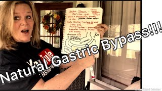 Natural Gastric Bypass!!!